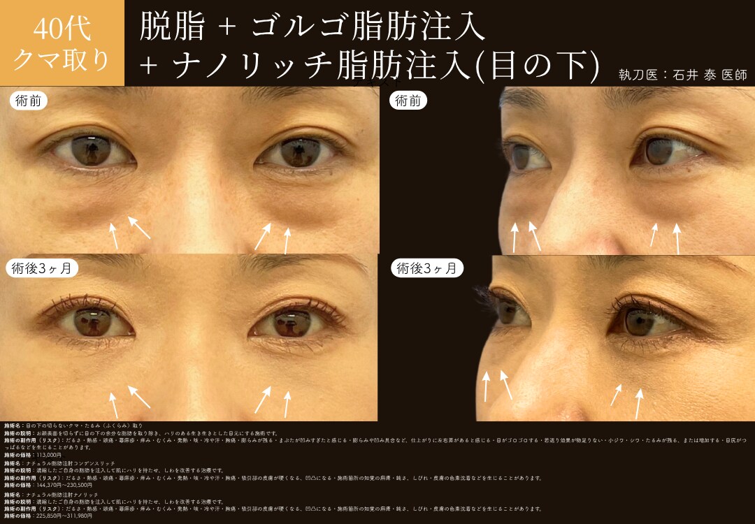 ピックアップ症例